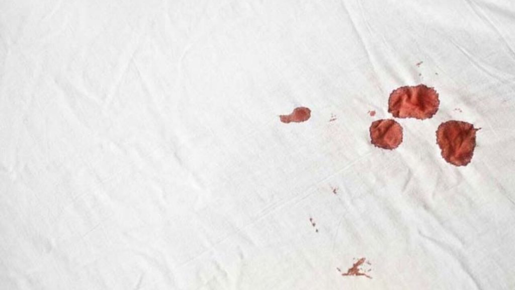 How to Get Blood Out of Mattress